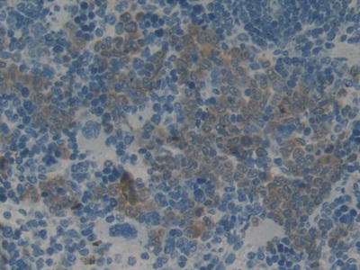 Monoclonal Antibody to Plasminogen Activator Inhibitor 2 (PAI2)