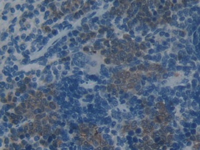 Monoclonal Antibody to Plasminogen Activator Inhibitor 2 (PAI2)