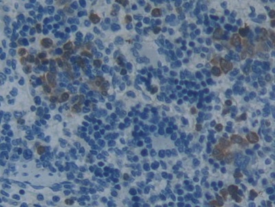 Monoclonal Antibody to Plasminogen Activator Inhibitor 2 (PAI2)