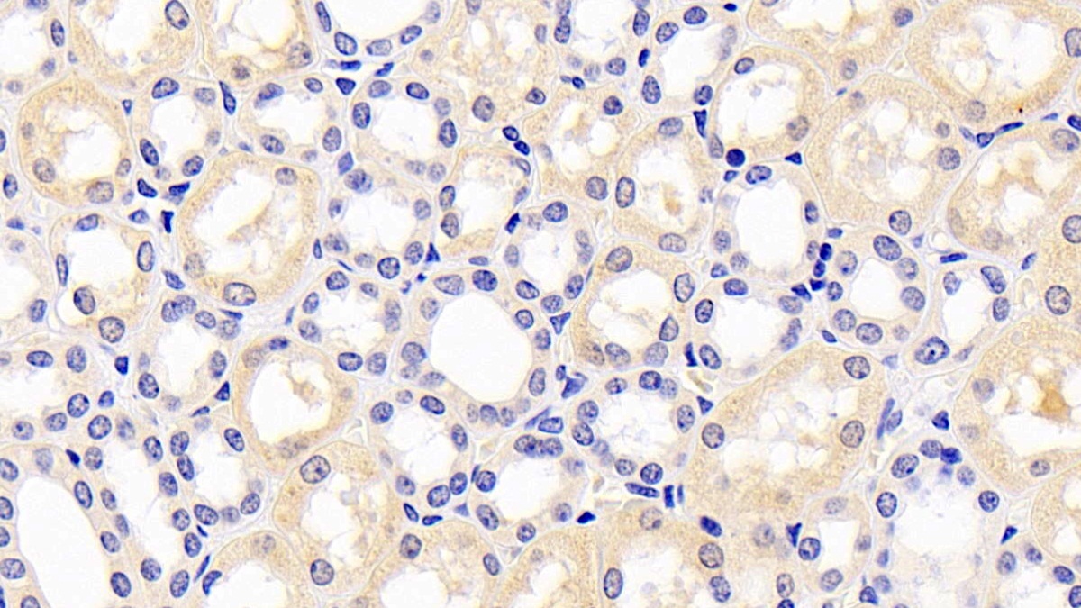 Monoclonal Antibody to Plasminogen Activator Inhibitor 1 (PAI1)