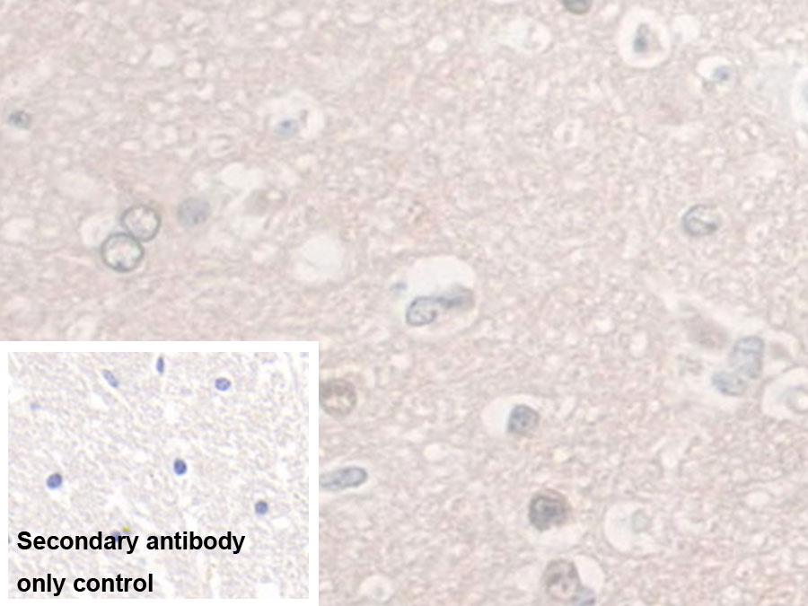 Monoclonal Antibody to Enolase, Neuron Specific (NSE)