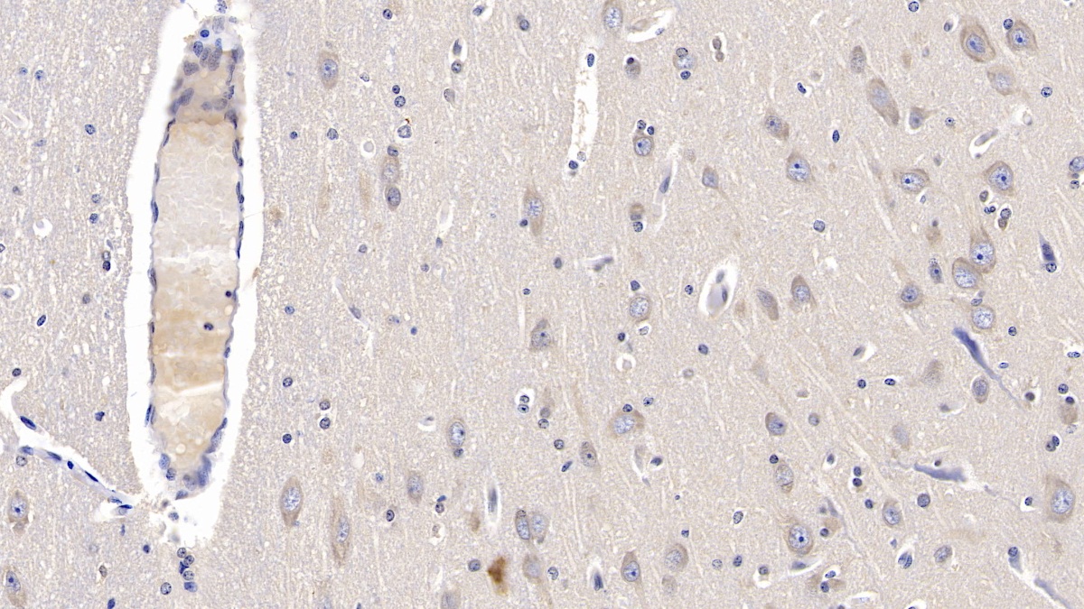 Monoclonal Antibody to Myelin Basic Protein (MBP)