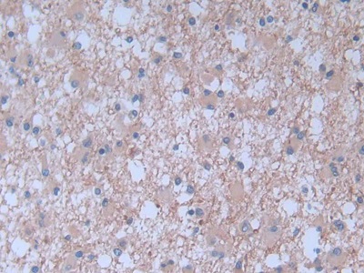 Monoclonal Antibody to Brain Natriuretic Peptide (BNP)