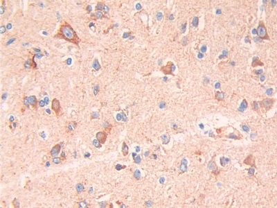 Monoclonal Antibody to Brain Natriuretic Peptide (BNP)