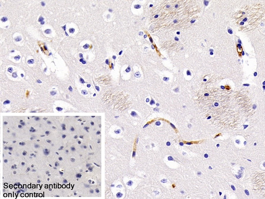 Monoclonal Antibody to Immunoglobulin G (IgG)