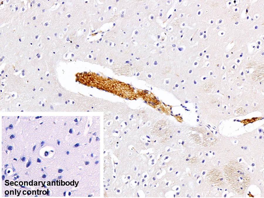 Monoclonal Antibody to Immunoglobulin G (IgG)