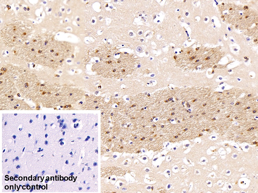 Monoclonal Antibody to Immunoglobulin G (IgG)