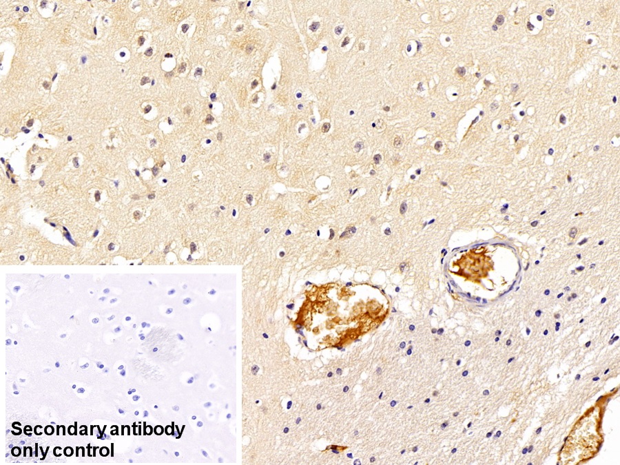 Monoclonal Antibody to Immunoglobulin G (IgG)