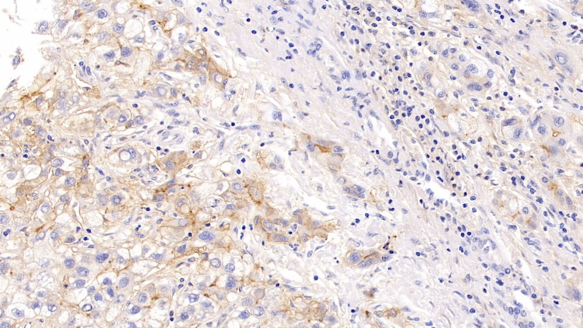 Monoclonal Antibody to Intercellular Adhesion Molecule 1 (ICAM1)