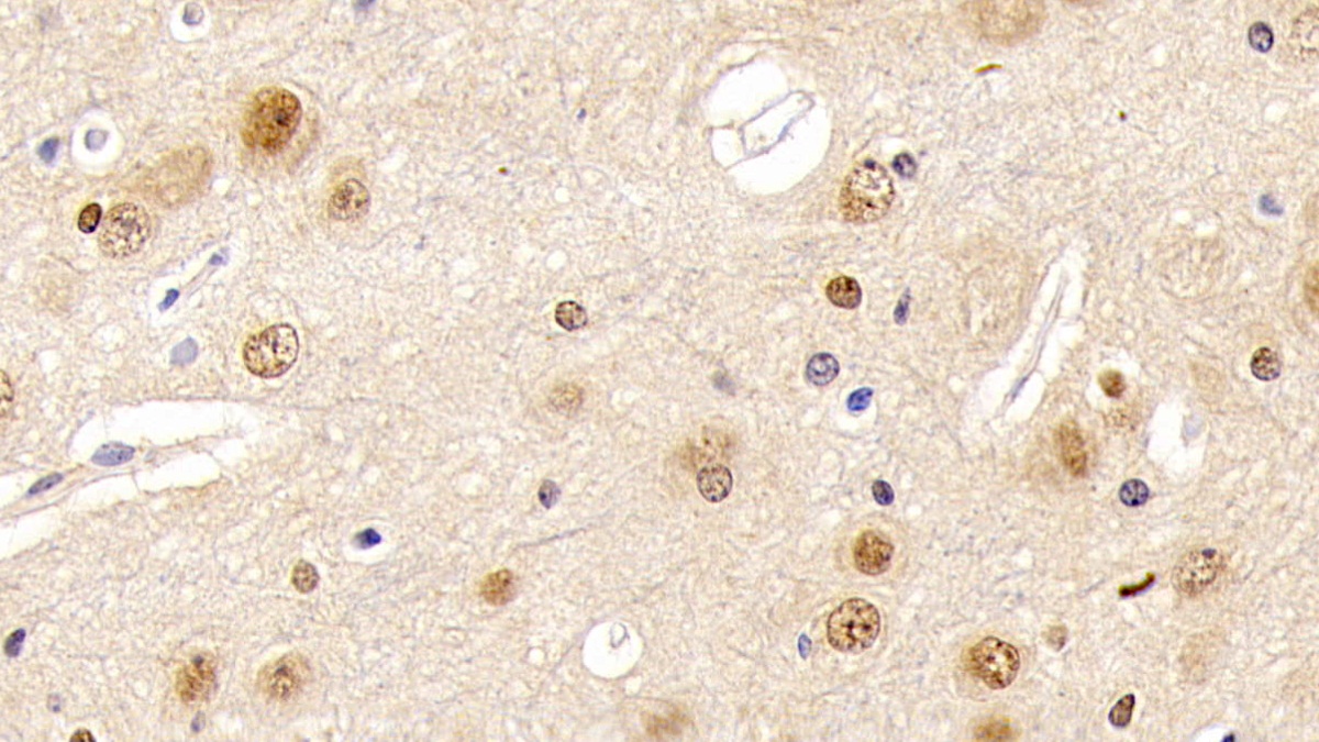 Monoclonal Antibody to Fibroblast Growth Factor 2, Basic (FGF2)