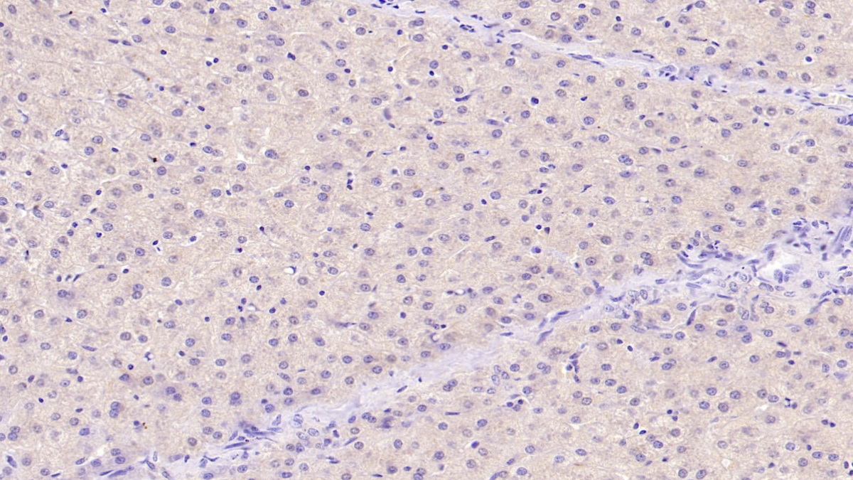 Monoclonal Antibody to Tissue Inhibitors Of Metalloproteinase 1 (TIMP1)