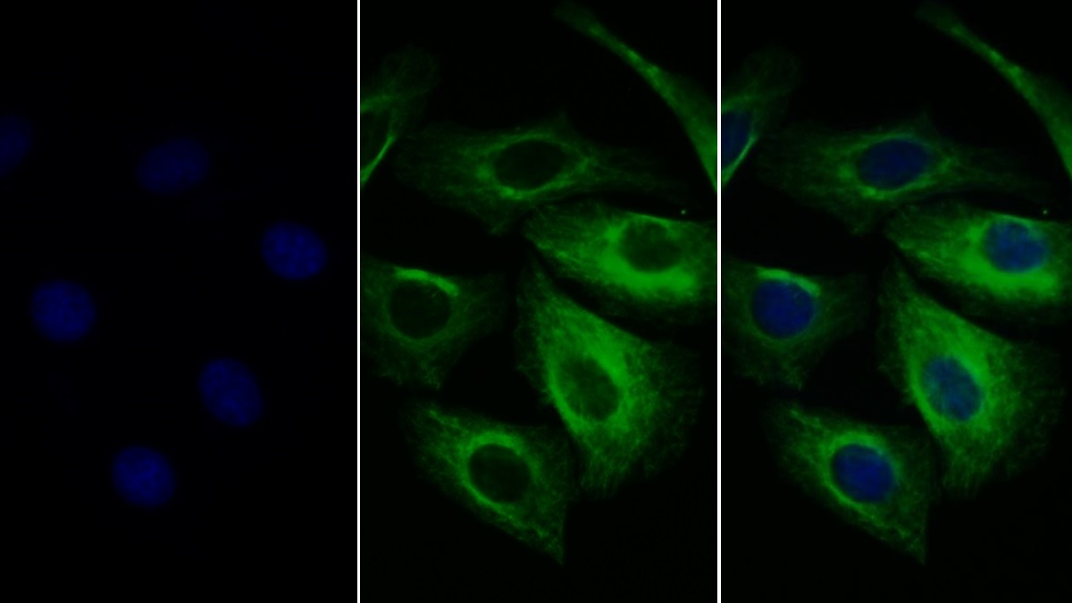 Monoclonal Antibody to Cytokeratin 7 (CK7)