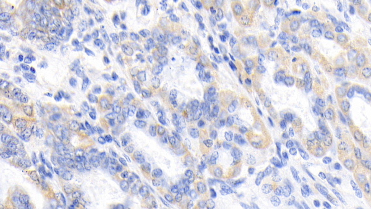 Monoclonal Antibody to Epidermal Growth Factor (EGF)