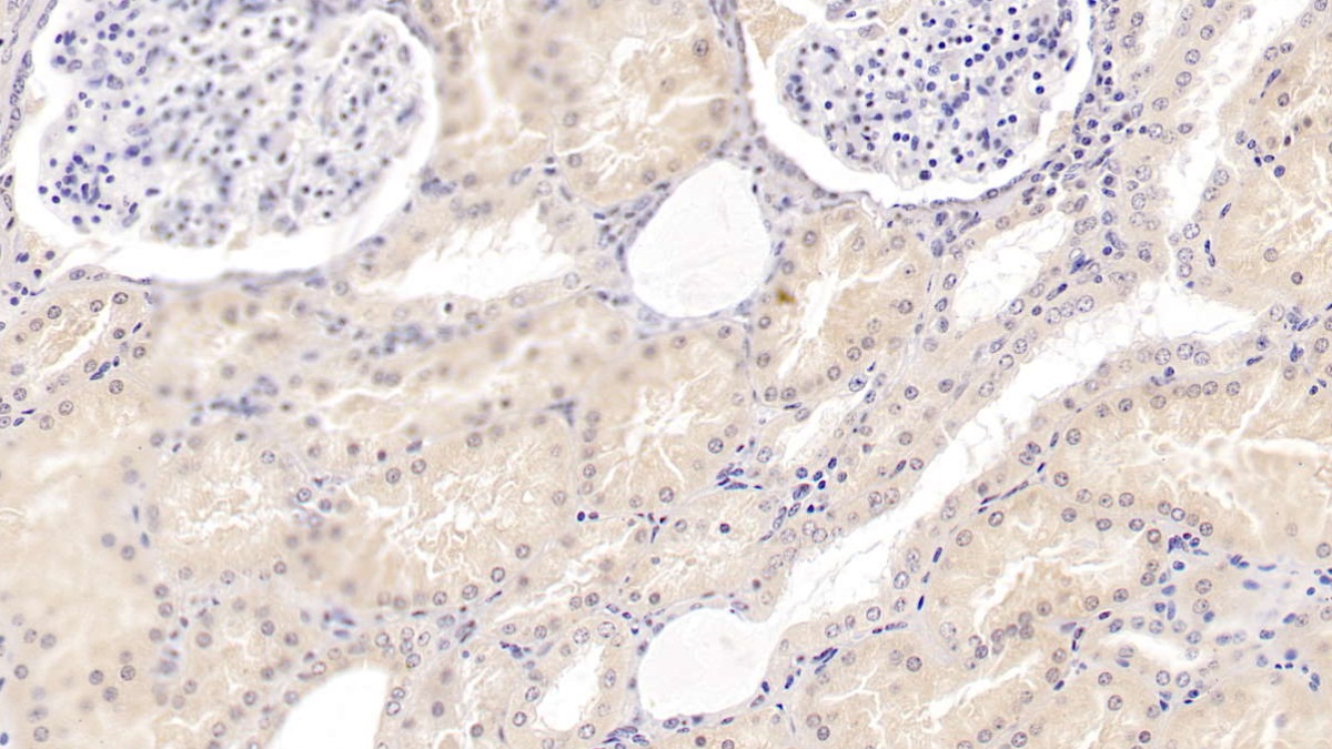 Monoclonal Antibody to Epidermal Growth Factor (EGF)