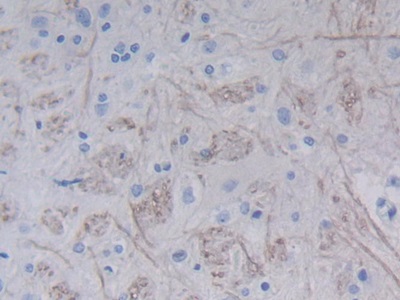 Monoclonal Antibody to Epidermal Growth Factor (EGF)