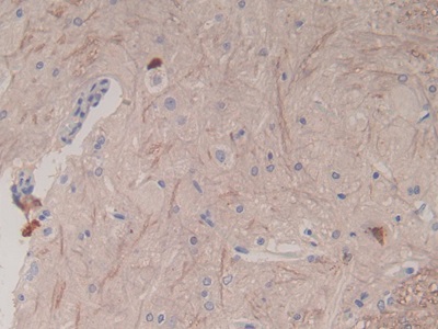 Monoclonal Antibody to Epidermal Growth Factor (EGF)