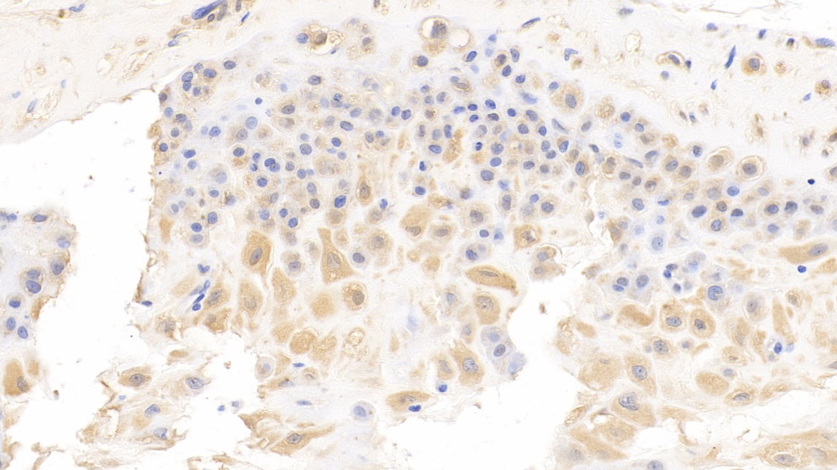 Monoclonal Antibody to P-Selectin (SELP)