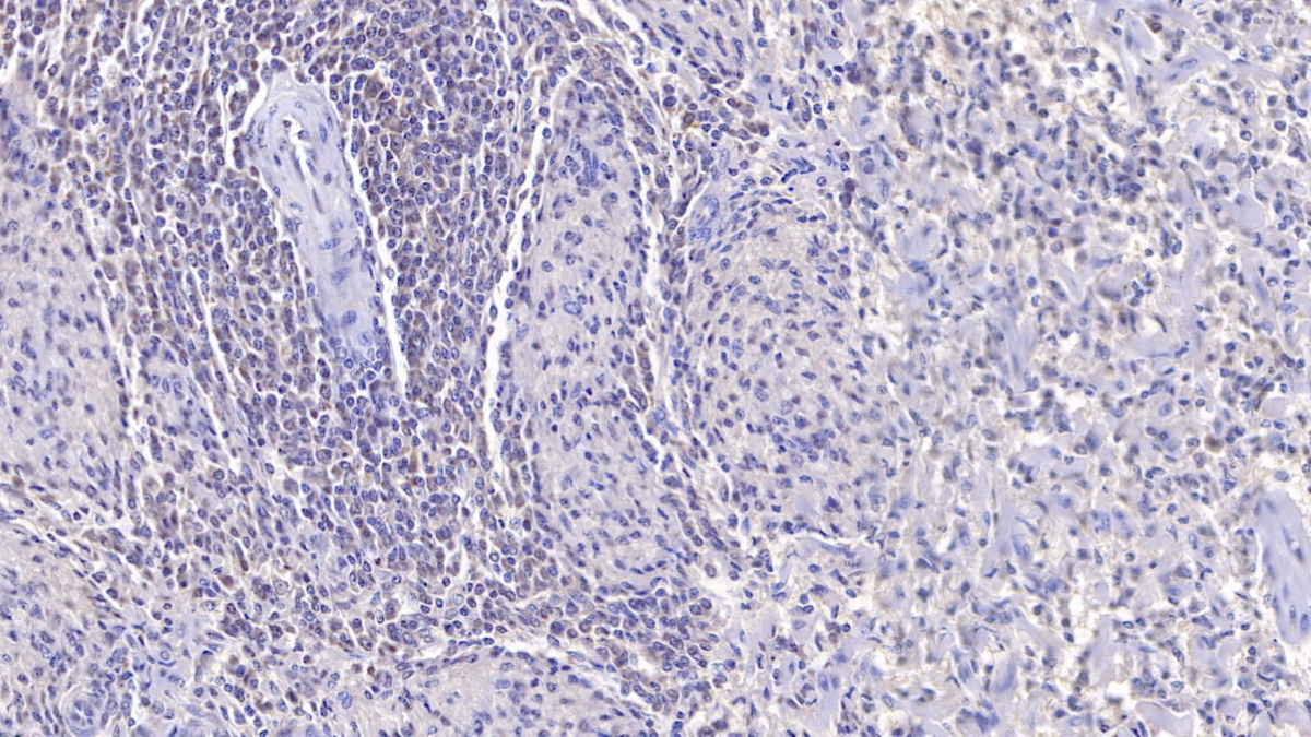 Monoclonal Antibody to P-Selectin (SELP)