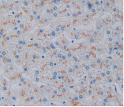 Monoclonal Antibody to Heme Oxygenase 1 (HO1)