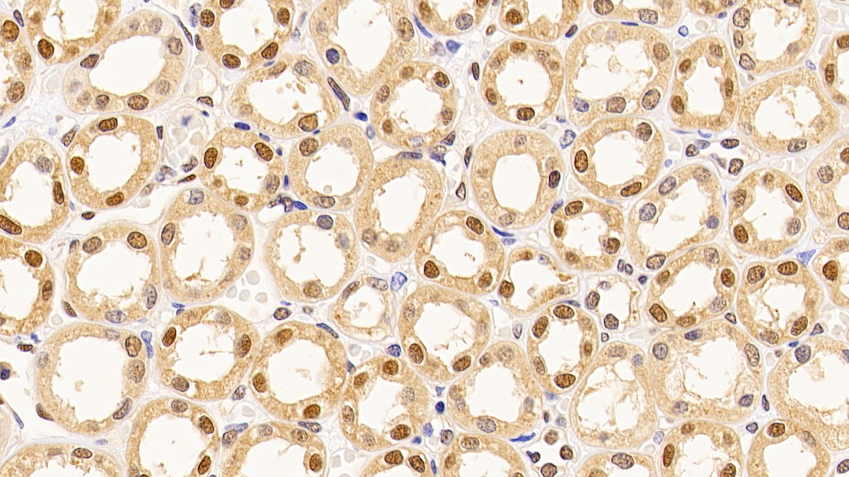 Monoclonal Antibody to Proliferating Cell Nuclear Antigen (PCNA)