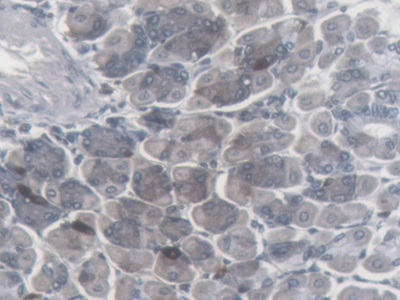 Monoclonal Antibody to Somatostatin (SST)