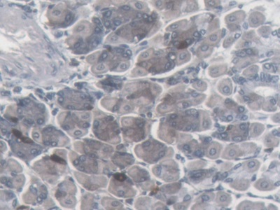 Monoclonal Antibody to Somatostatin (SST)