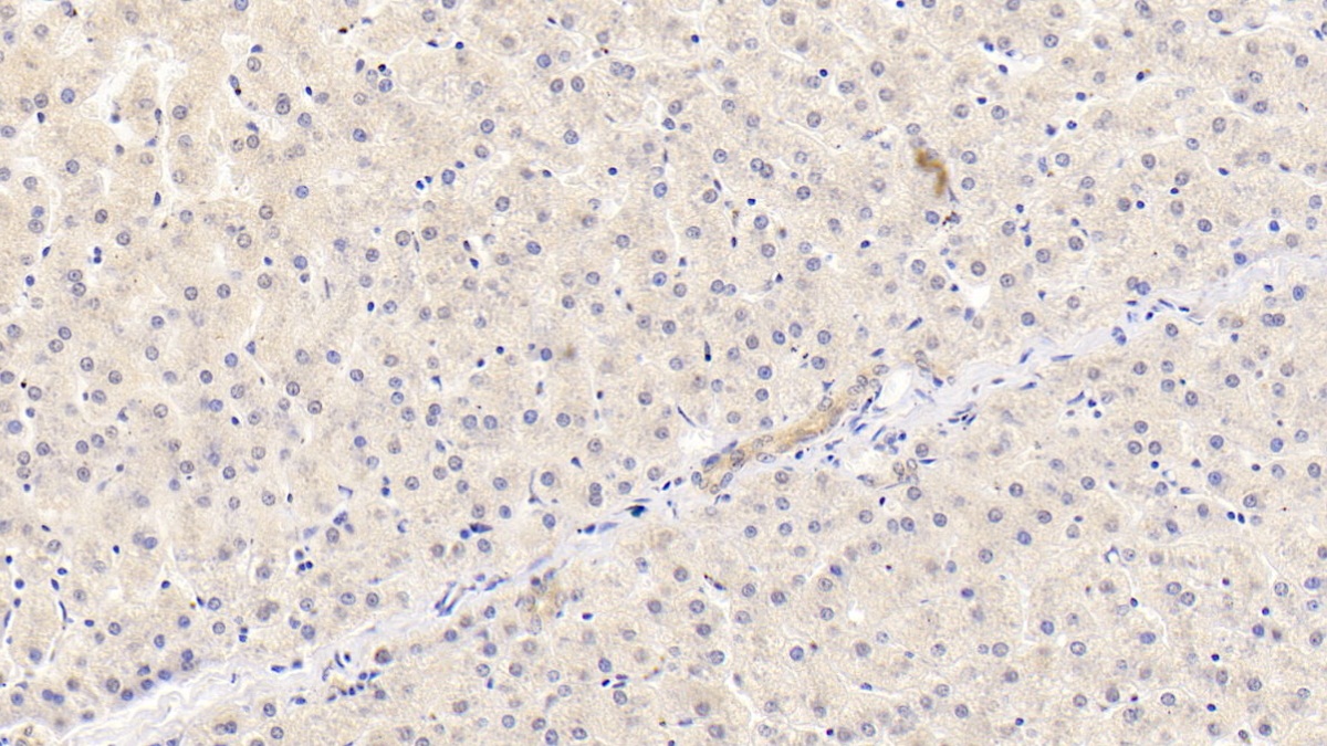 Monoclonal Antibody to Apolipoprotein B100 (APOB100)