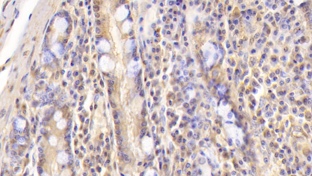 Monoclonal Antibody to Apolipoprotein B100 (APOB100)