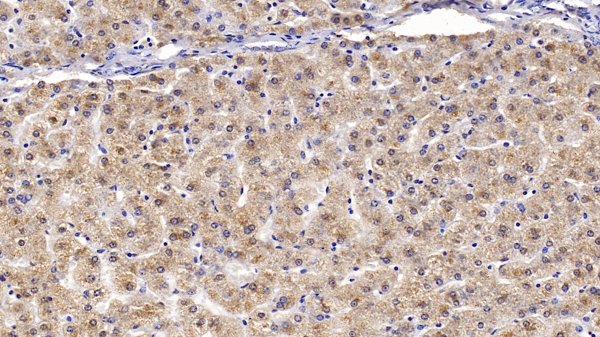 Monoclonal Antibody to Apolipoprotein B100 (APOB100)