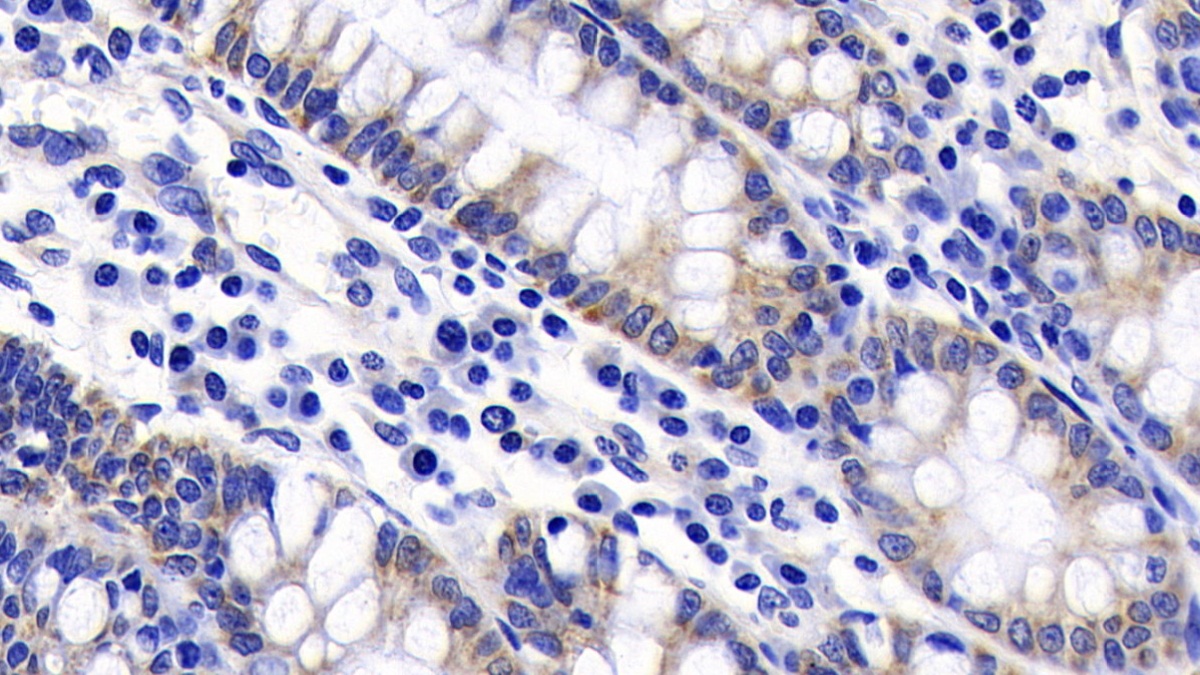 Monoclonal Antibody to Caspase 9 (CASP9)