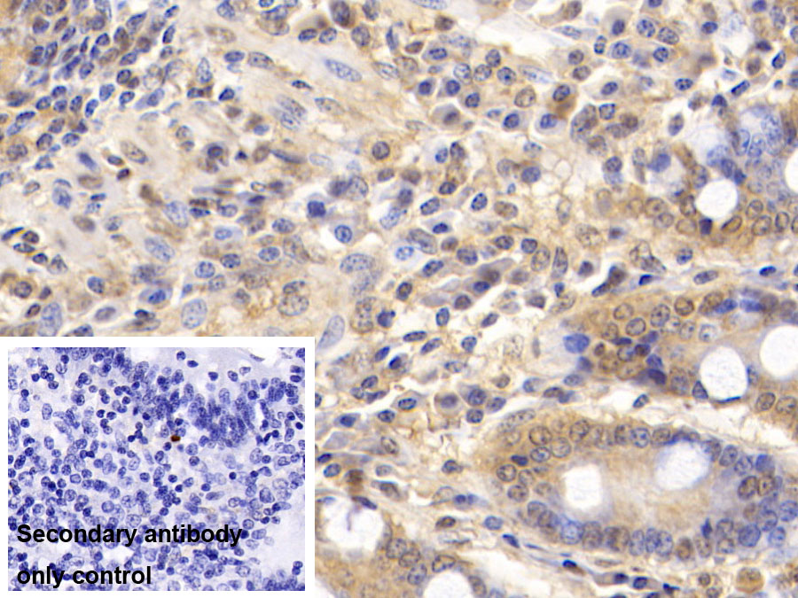 Monoclonal Antibody to Visfatin (VF)