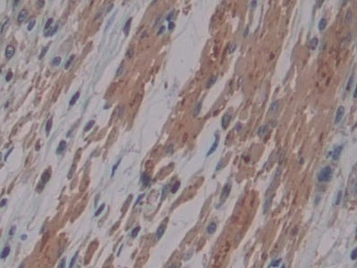 Monoclonal Antibody to Cross Linked N-Telopeptide Of Type I Collagen (NTXI)