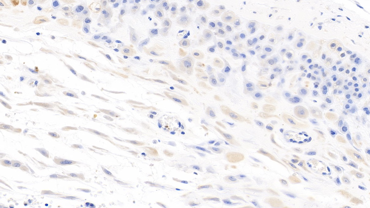 Monoclonal Antibody to Interleukin 7 (IL7)