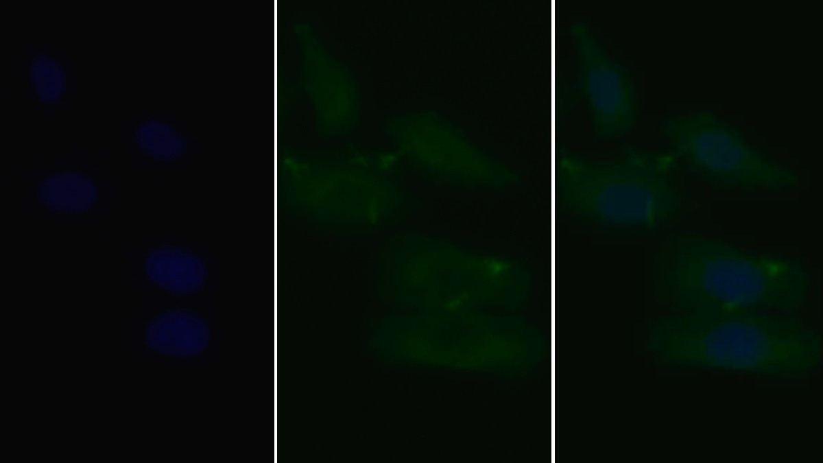 Monoclonal Antibody to Toll Like Receptor 2 (TLR2)