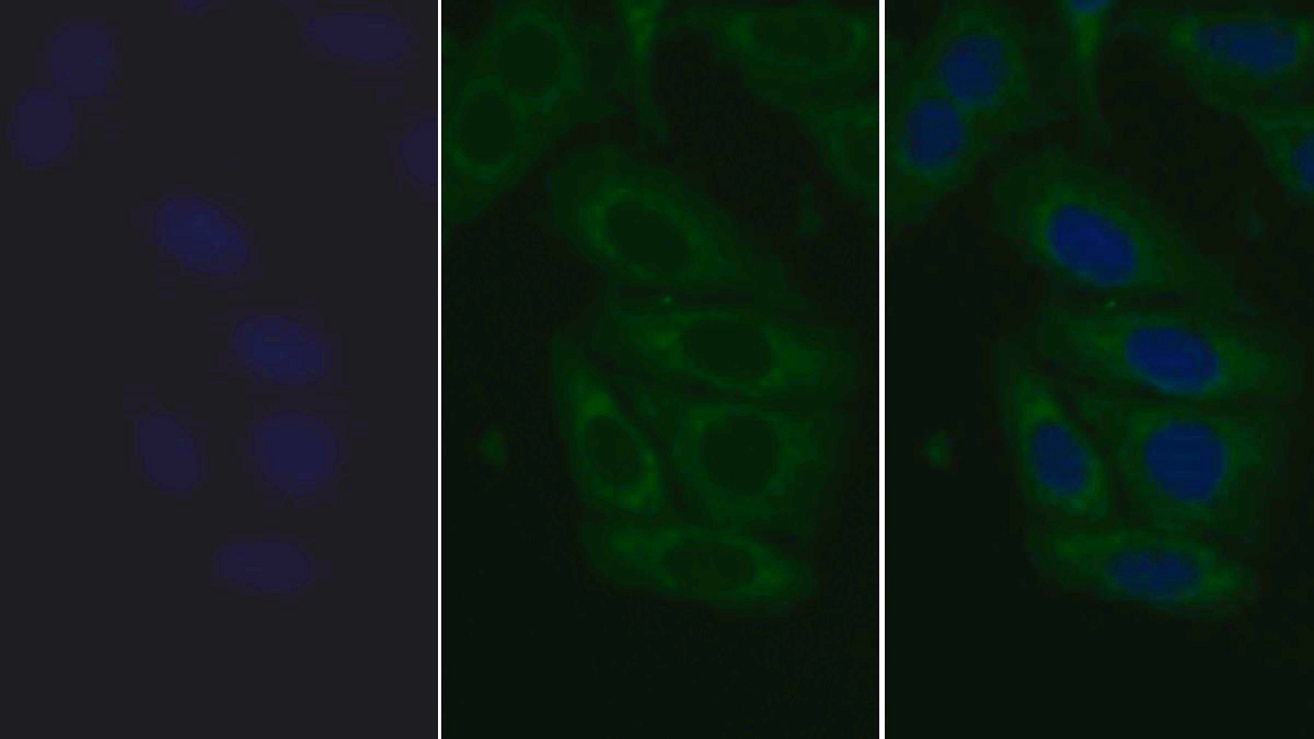 Monoclonal Antibody to Toll Like Receptor 2 (TLR2)