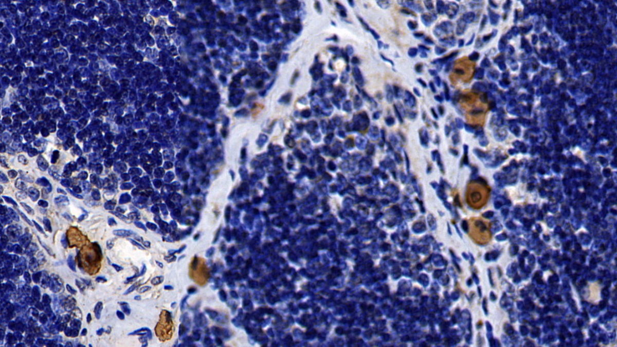 Monoclonal Antibody to Toll Like Receptor 2 (TLR2)