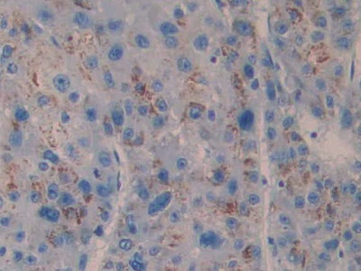 Monoclonal Antibody to Cross Linked C-Telopeptide Of Type I Collagen (CTXI)