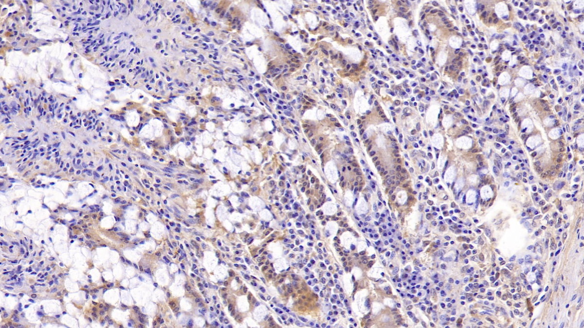 Monoclonal Antibody to Mucin 5 Subtype B (MUC5B)