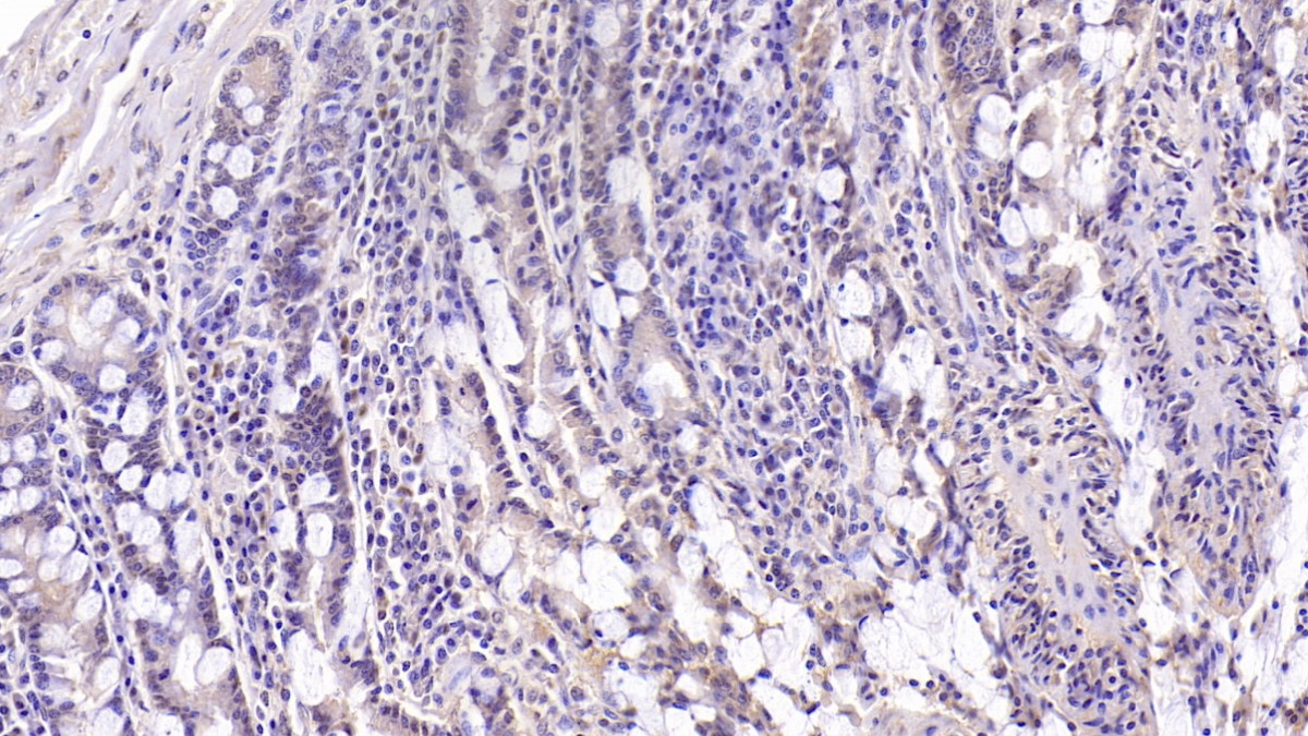 Monoclonal Antibody to Mucin 5 Subtype B (MUC5B)