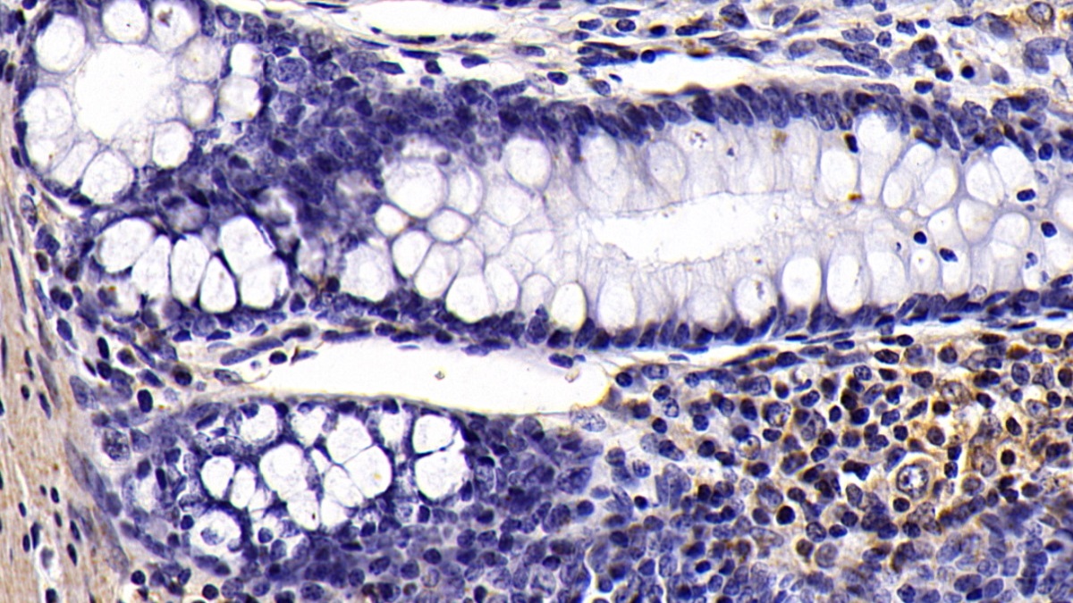 Monoclonal Antibody to Cluster Of Differentiation 14 (CD14)