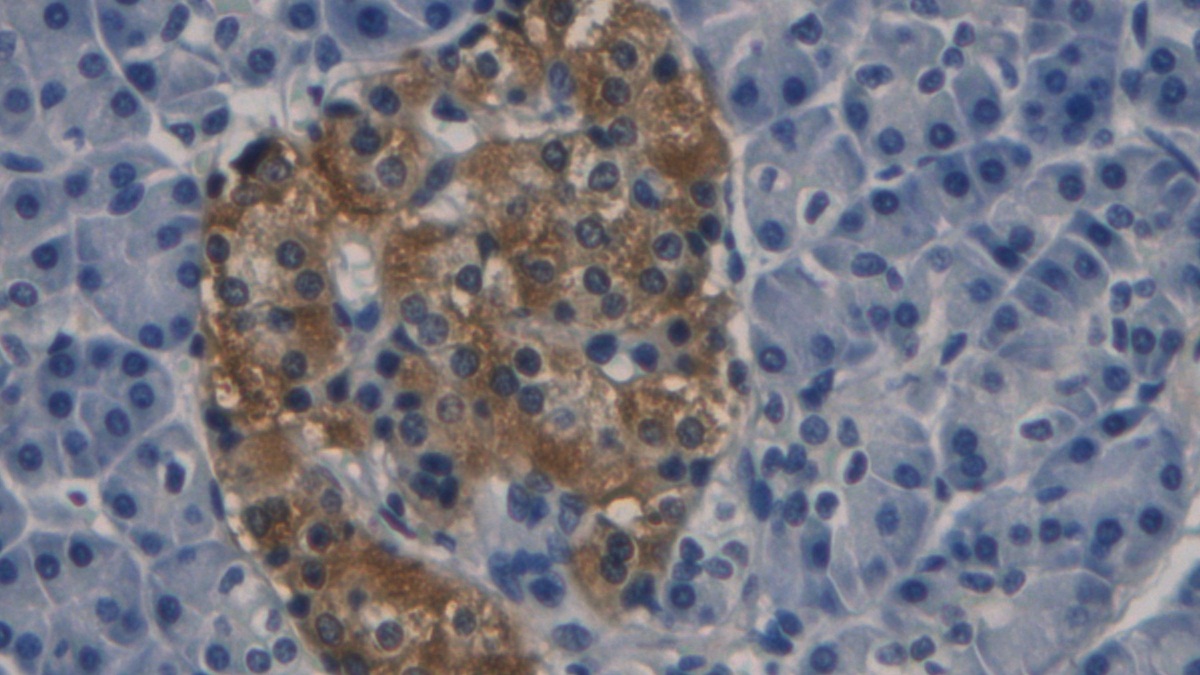 Monoclonal Antibody to Procalcitonin (PCT)