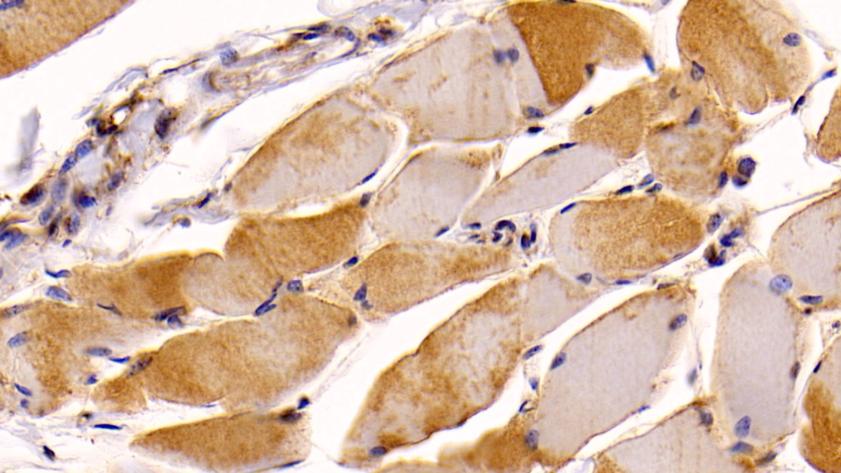 Monoclonal Antibody to Neuropilin 1 (NRP1)