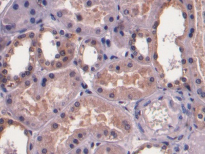 Monoclonal Antibody to Prothrombin Fragment 1+2 (F1+2)