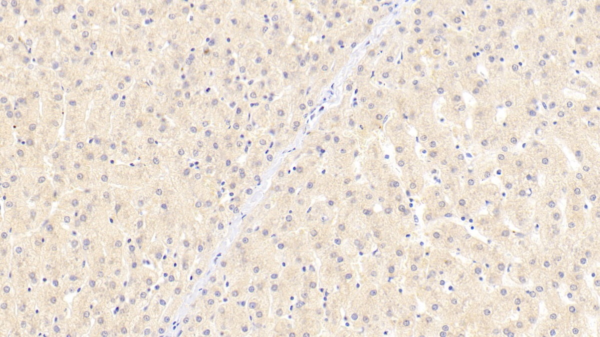 Monoclonal Antibody to Beta-Site APP Cleaving Enzyme 1 (bACE1)