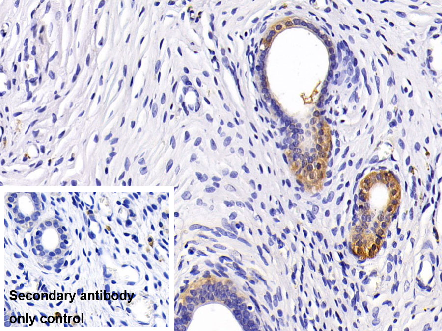 Monoclonal Antibody to Dickkopf Related Protein 1 (DKK1)