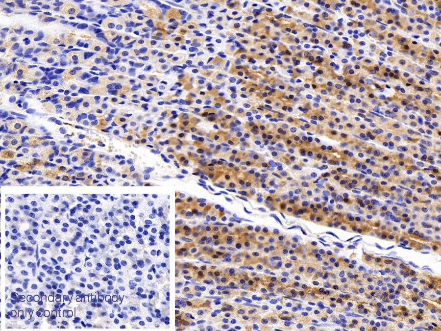 Monoclonal Antibody to Trefoil Factor 2 (TFF2)