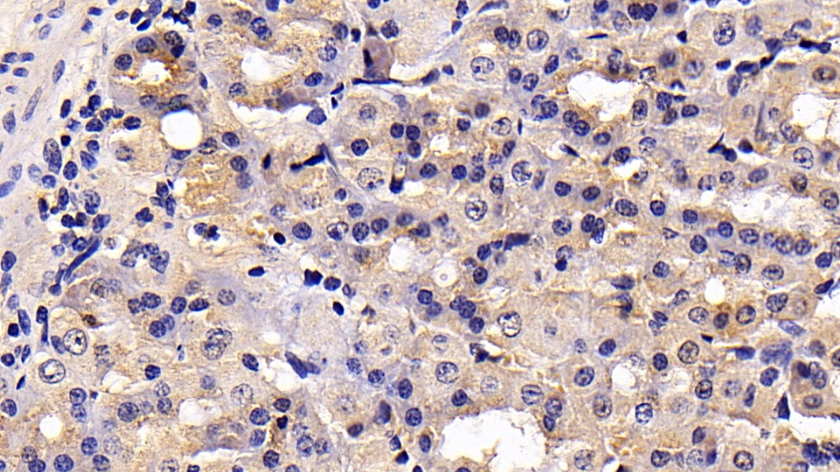 Monoclonal Antibody to Toll Like Receptor 4 (TLR4)