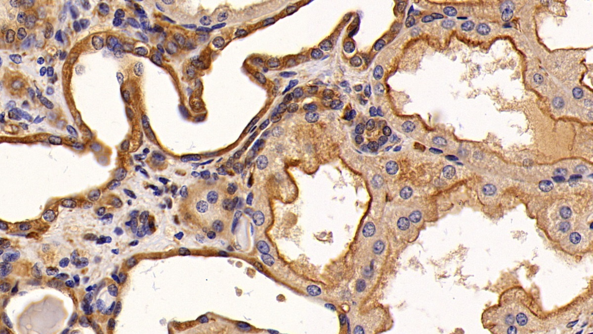 Monoclonal Antibody to Epidermal Growth Factor Receptor (EGFR)