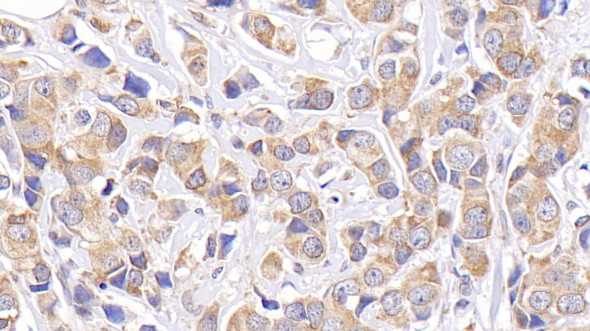 Monoclonal Antibody to B-Cell Leukemia/Lymphoma 2 (Bcl2)