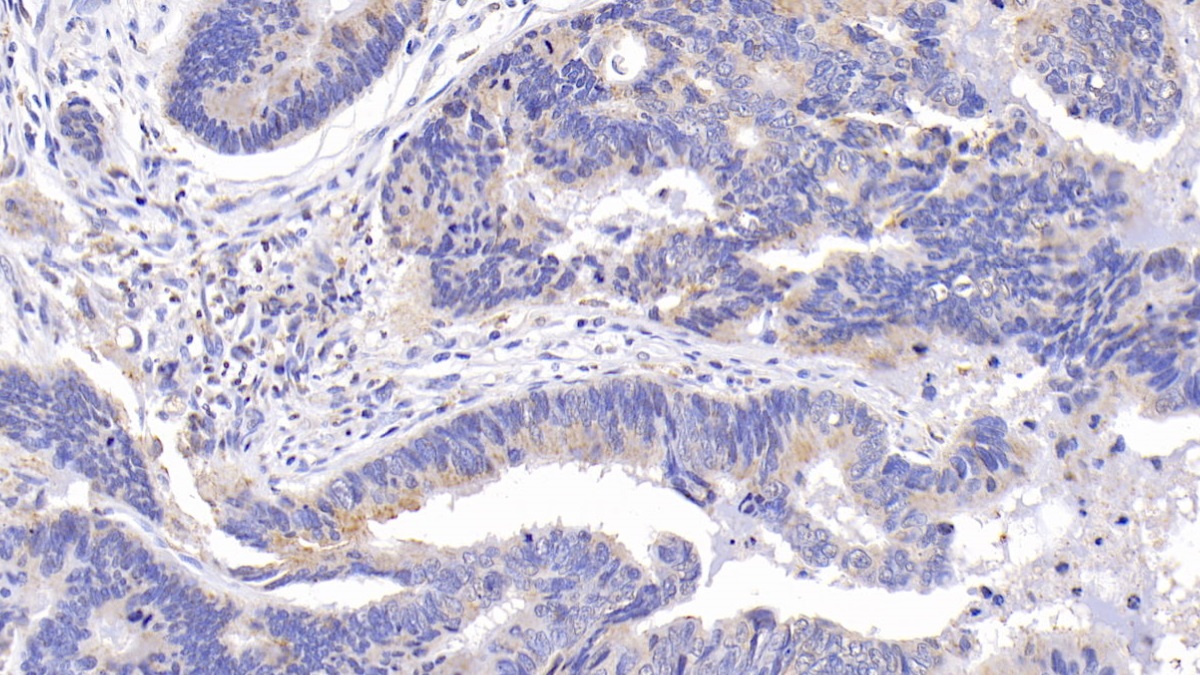 Monoclonal Antibody to B-Cell Leukemia/Lymphoma 2 (Bcl2)